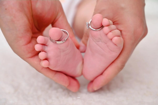 浙江怀孕妊娠线不明显